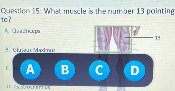 Question 15: What muscle is the number 13 pointing
to?
A. Quadriceps
B. Gluteus Maximus
c
D. Gastrocnemtus